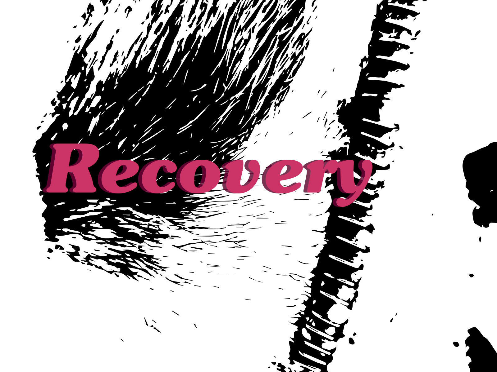 Recovering from microvascular decompression (MVD) surgery