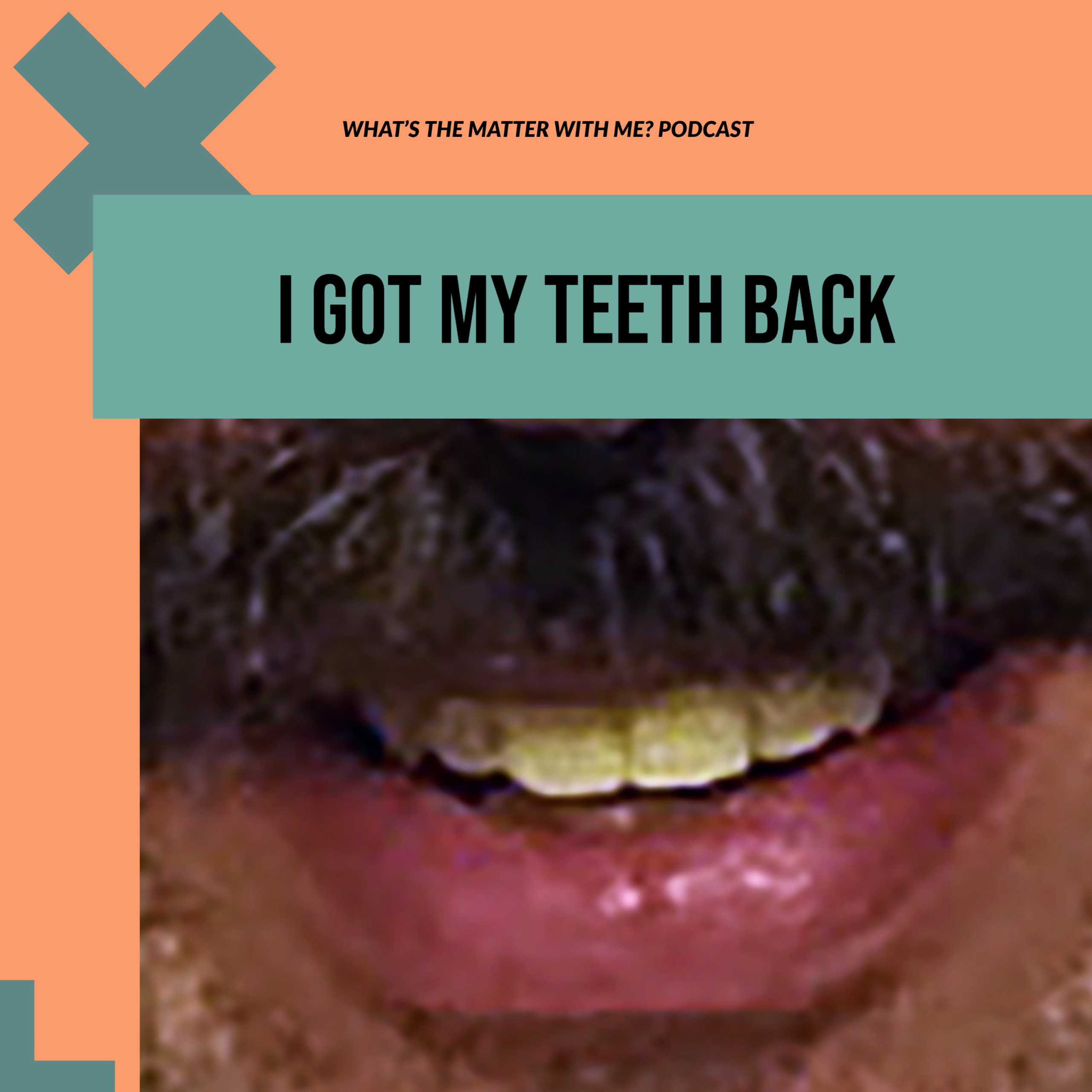 I Got My Teeth Back cover
