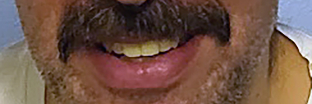 teeth