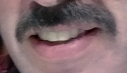 teeth 2